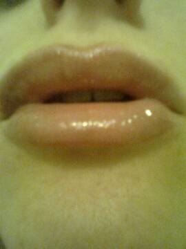 Foto pública de Stella-Argentata